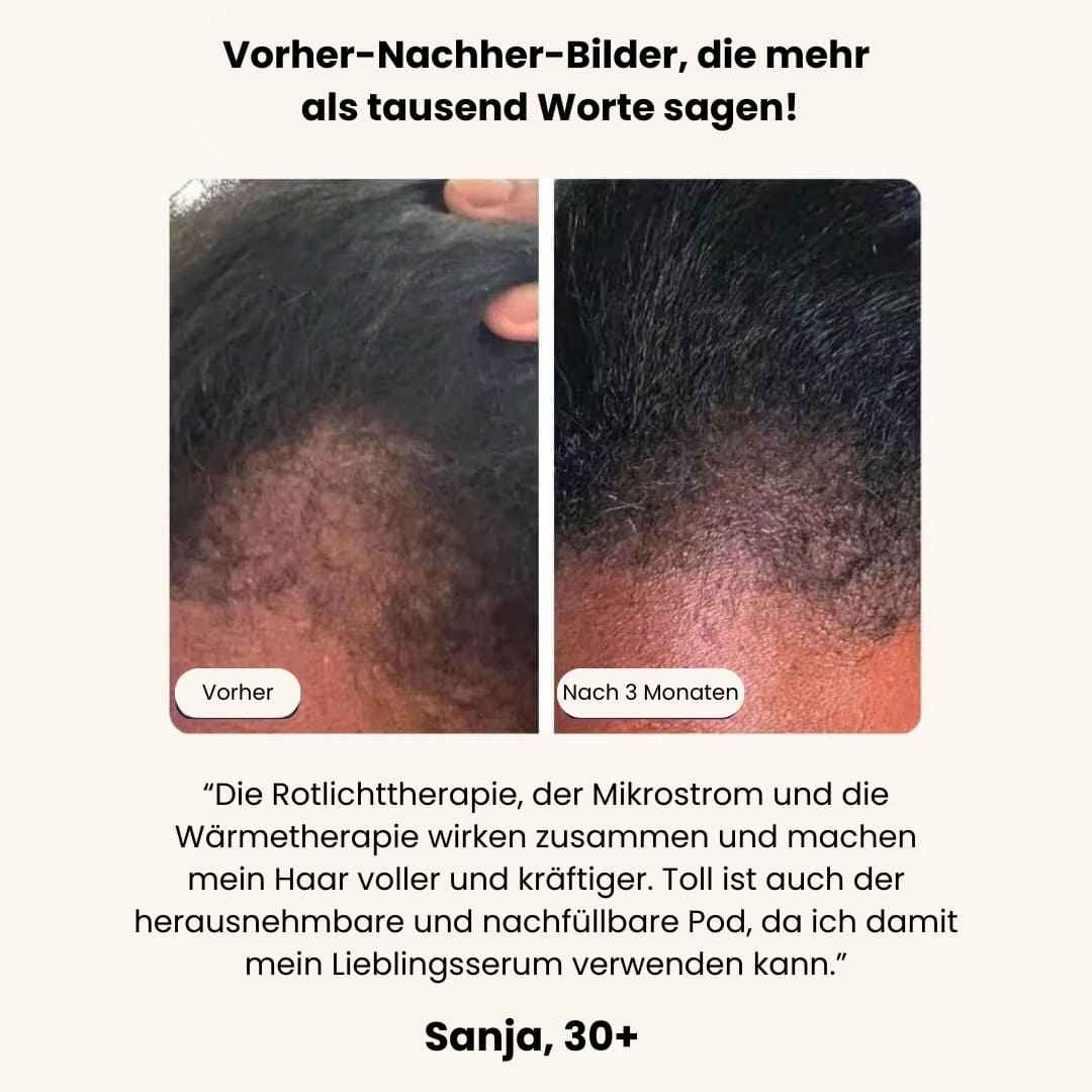 Hairpod™ - Haarbürste