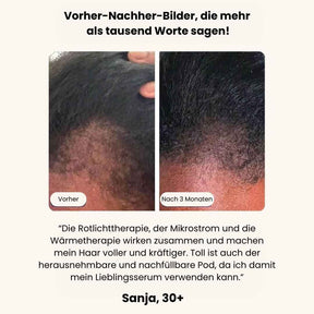 Hairpod™ - Haarbürste